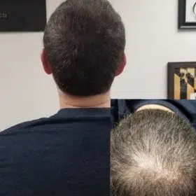 Men’s Density Fill