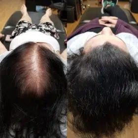 Women’s Density Fill